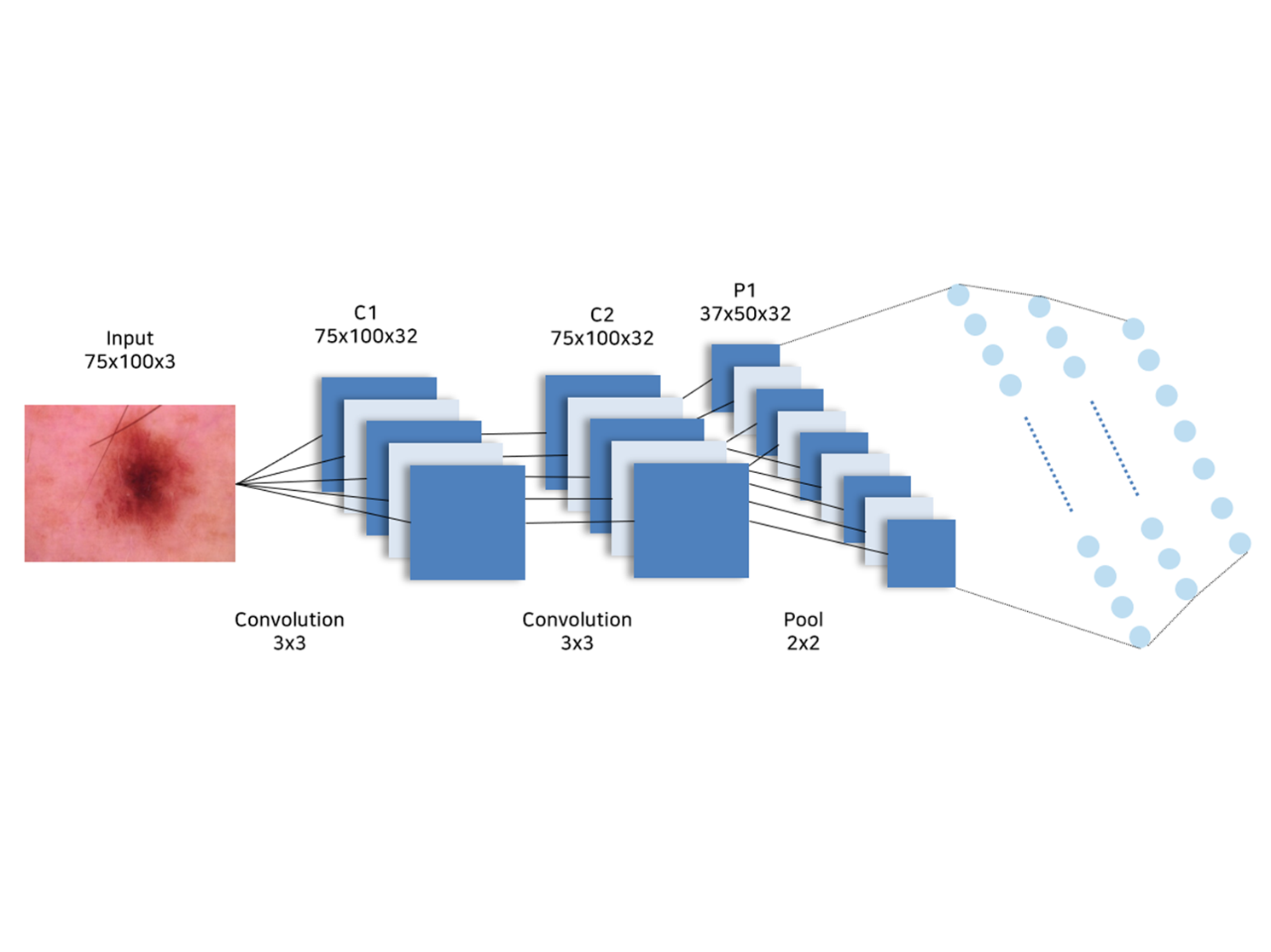 skin cancer prediction